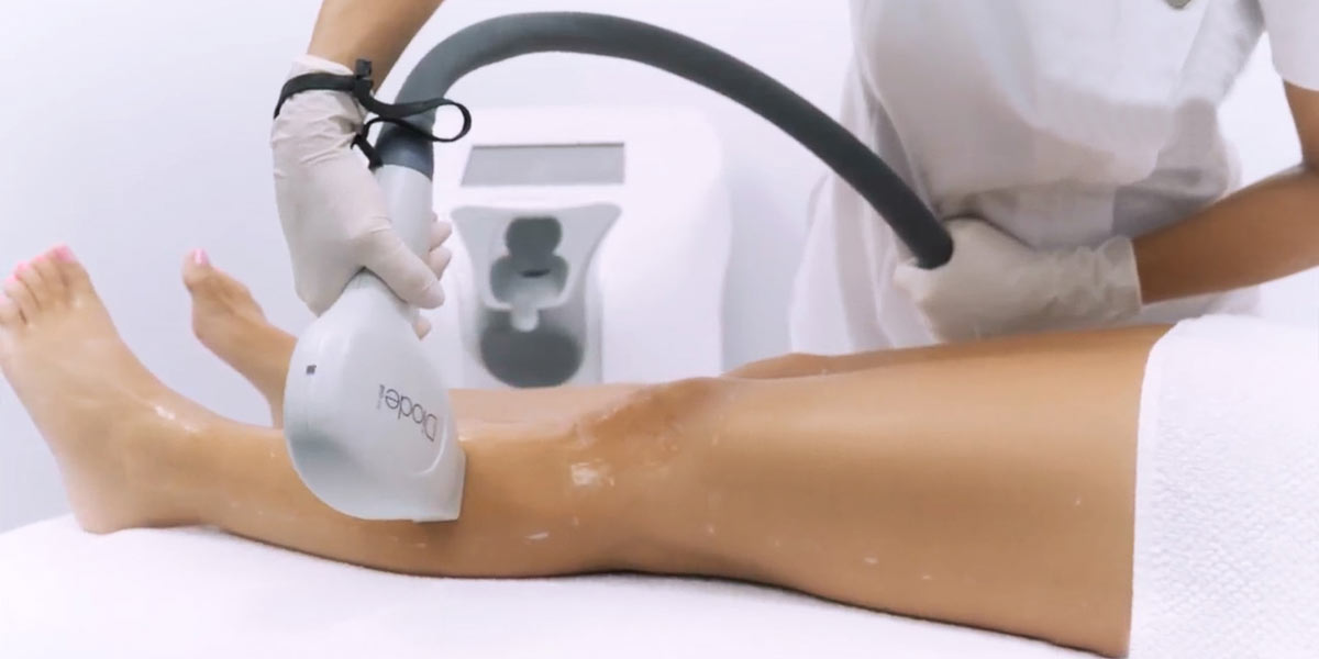 How does Laser Hair Removal work?